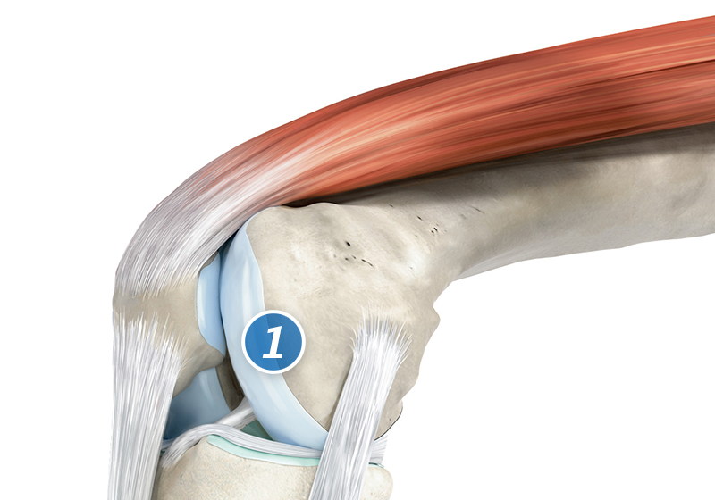 Grafikk av brusken og forskjellige andre kroppsstrukturer som binder to bein sammen  Grafikk av brusken og forskjellige andre kroppsstrukturer som binder to bein sammen